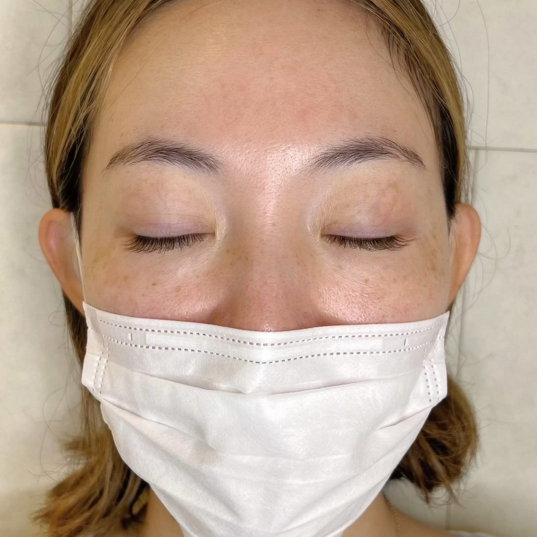 正面お顔全体 目を閉じているビフォー