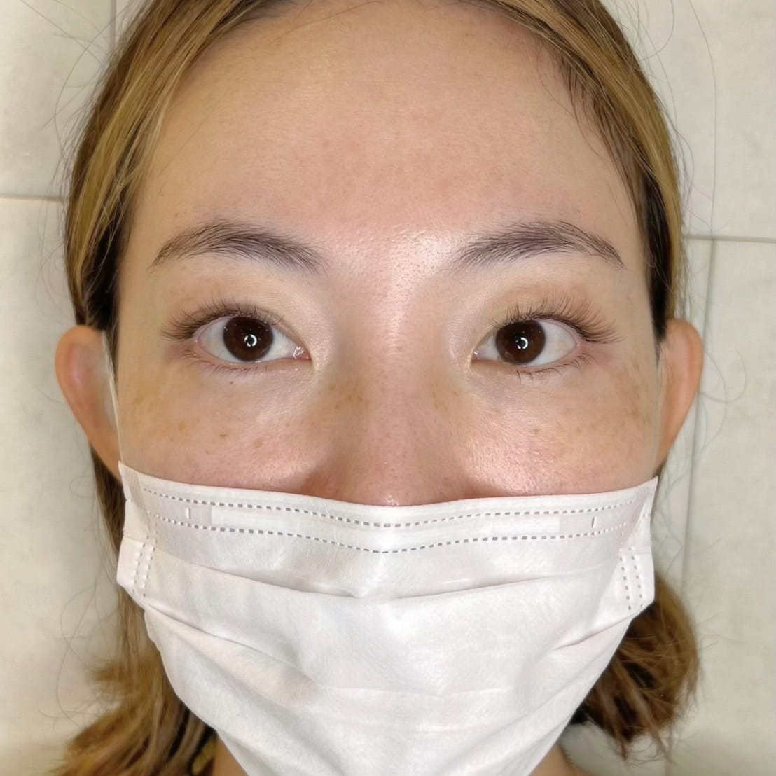 正面お顔全体 目を開けているビフォー