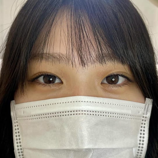 正面ビフォー