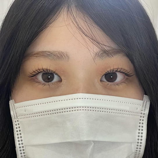 正面アフター